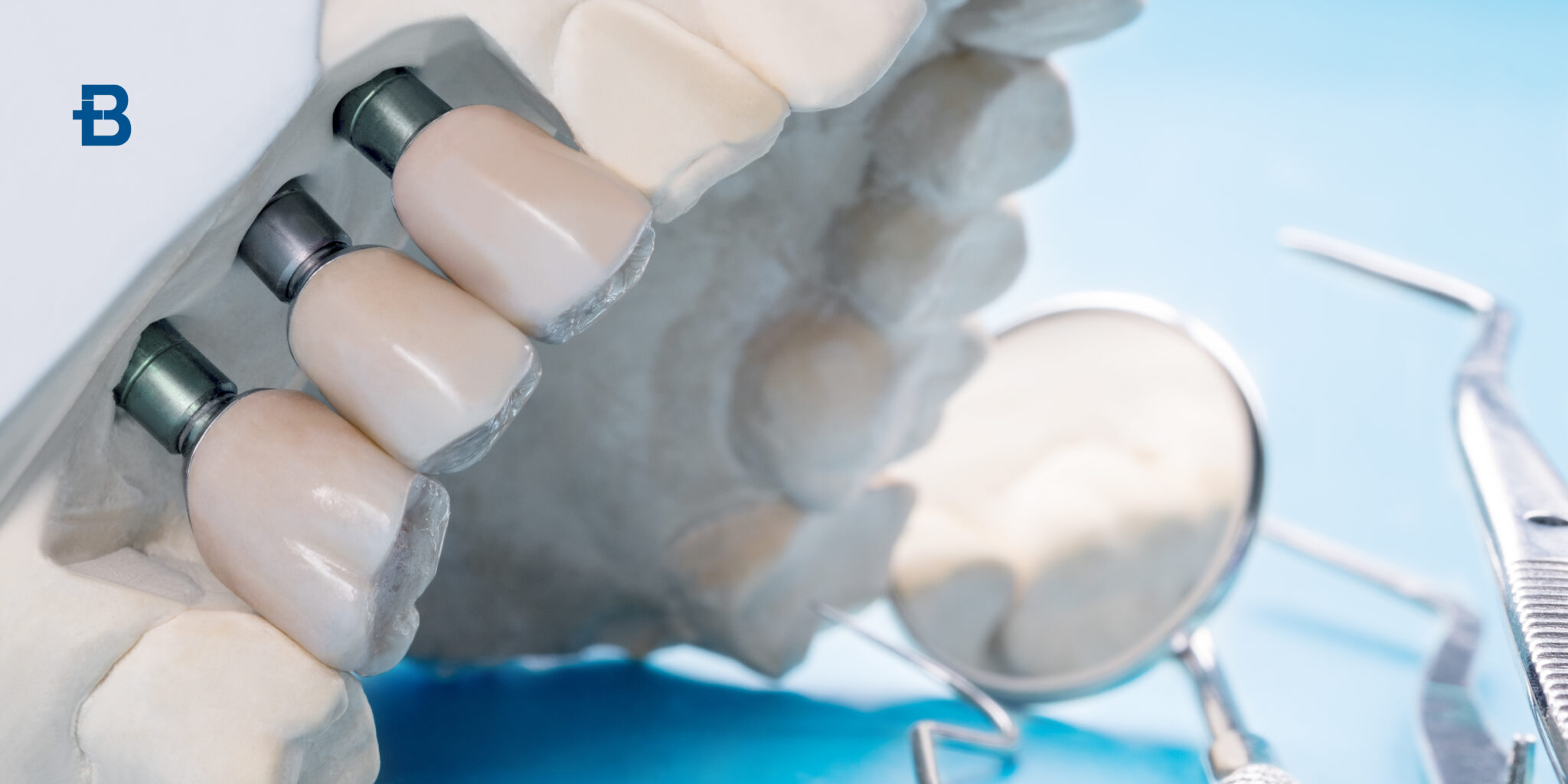 Bite dentale: guida completa all'uso e manutenzione - Bludental