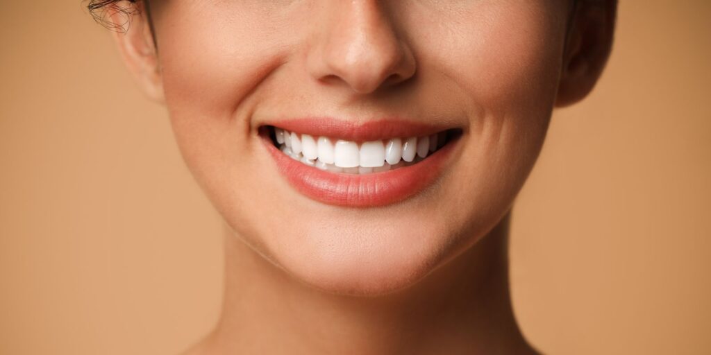 Faccette dentali
