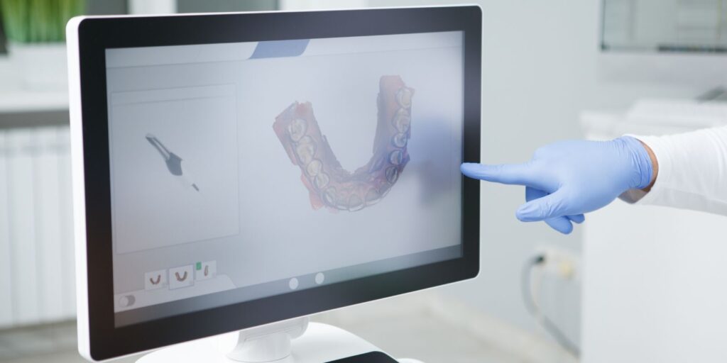 Scanner intraorale